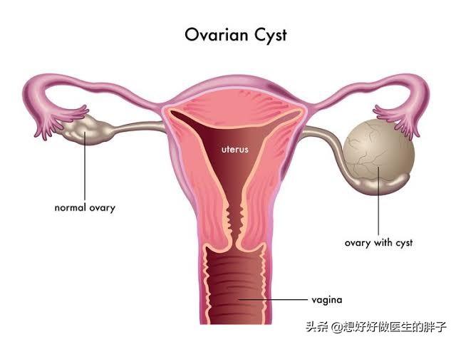 腹部分区,左腹部隐约有疼痛是什么情况？