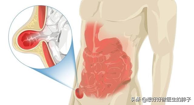 腹部分区,左腹部隐约有疼痛是什么情况？