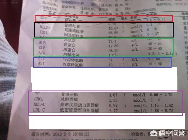 化验单怎么看,肝功能检查，怎么看报告？