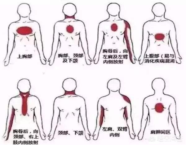 心脏供血不足能自愈吗,心血管供血不足有哪些症状？