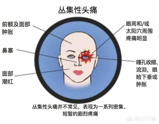 百度医生在线问答,经常头疼是什么原因引起的？