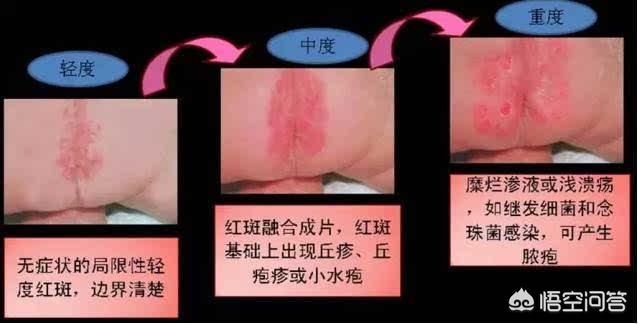 一片尿不湿用一个晚上可以吗？