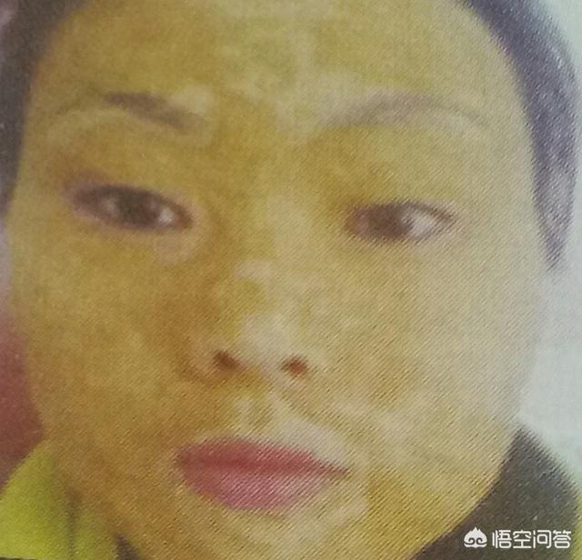 哪些祛痘面膜值得推荐呢？,祛痘面膜有用吗