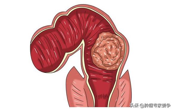 大便一粒一粒的像羊屎,有便意却拉不出来是什么原因？