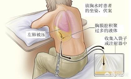 肺功能报告单主要看哪几项,肝功能检查，怎么看报告？