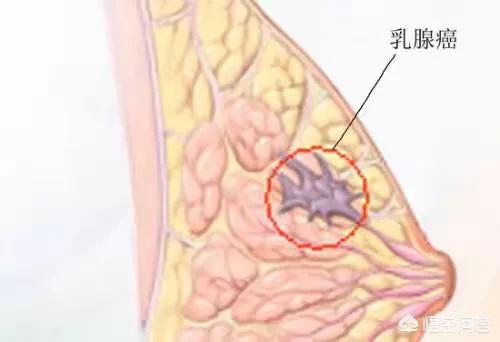 遗传病有哪些,有哪些遗传病会受到性别的影响？