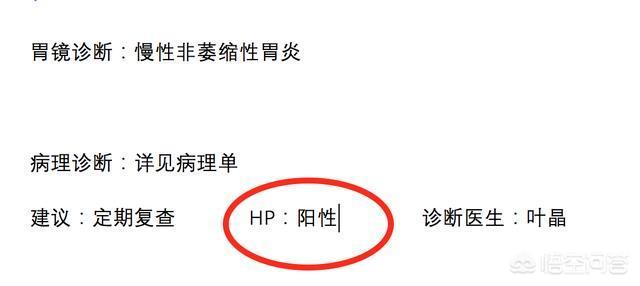 hp不是小天狼星,如果小天狼星是女的，HP剧情会如何发展？