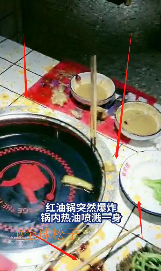 陈赫火锅店烫伤怎么赔偿,知名主持人爆料：陈赫火锅店火锅“炸伤”顾客，店家态度有点横