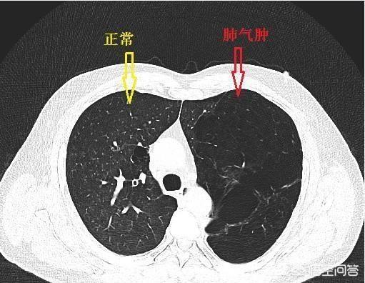 外推容积临床意义,食品毒理学实验的局限性？