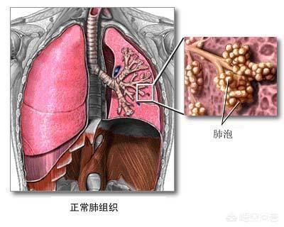 非典2003,2003年非典死亡人数？