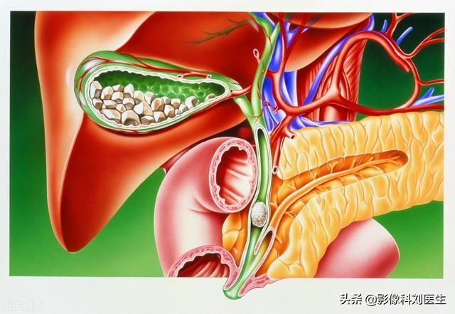 肚子突然绞痛缓解方法,腹部右上侧疼痛怎么缓解疼痛？