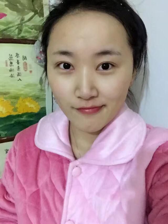 割双眼皮来赞东莞知美,女孩子割双眼皮真的好吗？