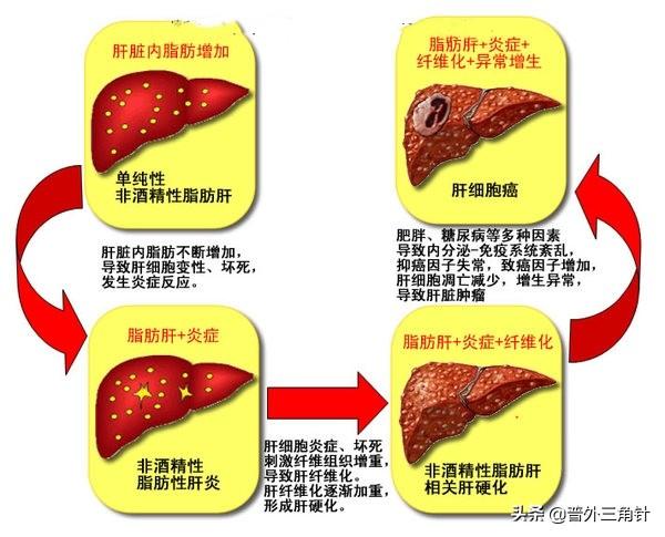 期门的准确位置图片,女性乳房两侧是什么穴位？