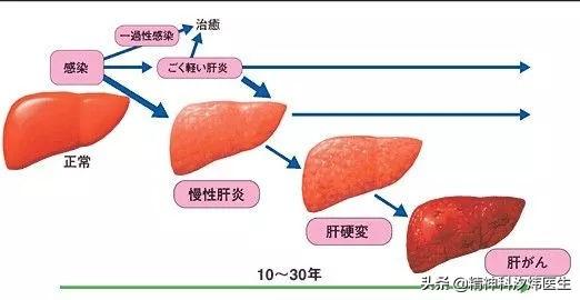 纳差是什么意思啊,为什么肝硬化腹水没力气？