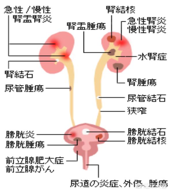 尿红色是什么原因,小便出血，可能是什么原因？