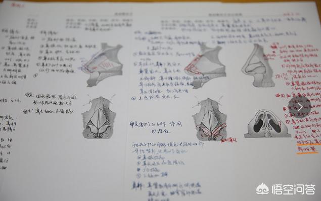 鼻软骨,全肋软骨隆鼻可以隆得更高大吗？