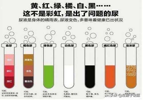 淡绿色尿液图片,不同颜色尿液是否预示不同疾病？