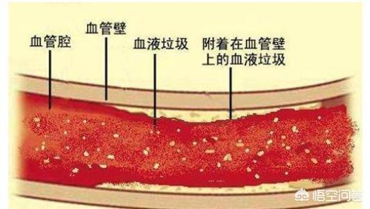 血脂稠如何调理,血液粘稠，如何“稀释”才好？