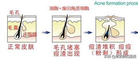 最有效的去黑头产品,去黑头最好的方法有哪些？