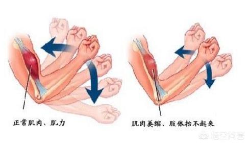 怎么瘦咬肌最有效,揉咬肌到底是变大还是变小？