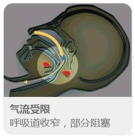 女人睡眠不好什么原因,晚上睡不好觉是什么回事？