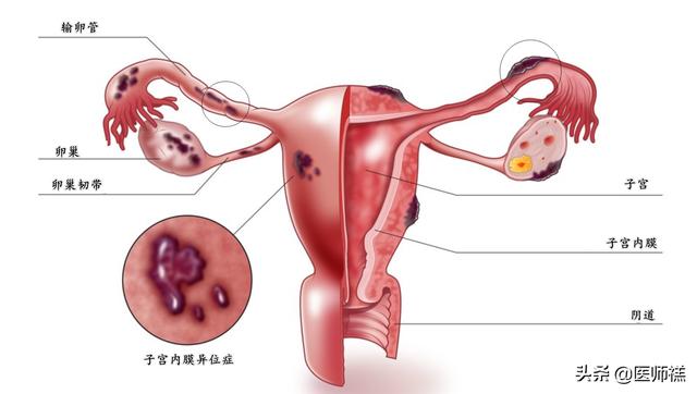 得了性疾病有什么症状,得了妇科疾病有哪些症状？