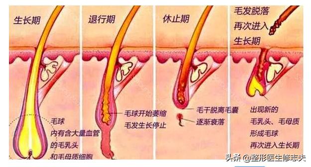 嘴上的小胡子怎么去掉,女孩嘴上小胡子怎样去除？