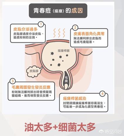 最有效祛痘方法,有什么真实有效的祛痘方法？