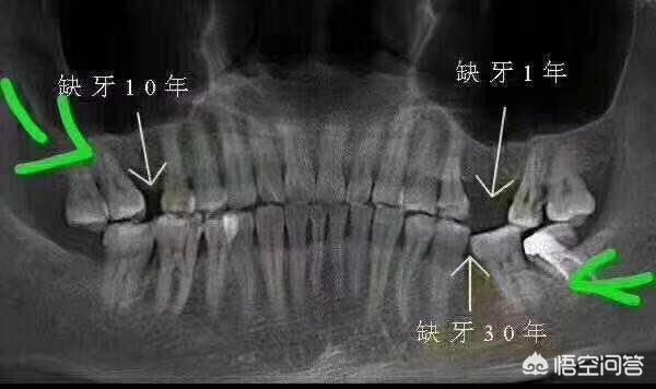 磨牙的危害,磨牙棒和磨牙饼干的利弊是什么？