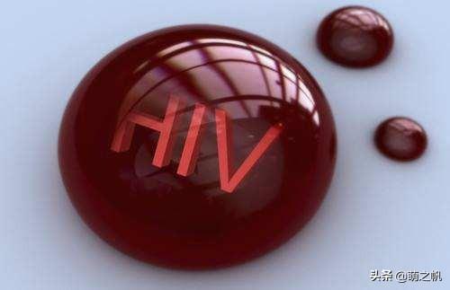 hiv是什么,血检出现-hiv是什么症状？