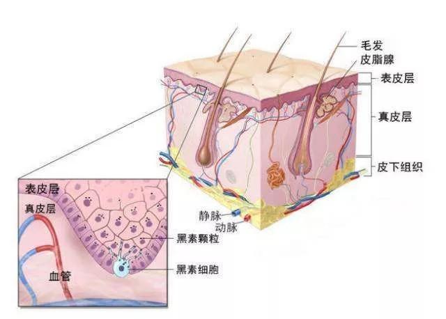 色素沉着疤痕,如何去除色素沉着性疤痕？