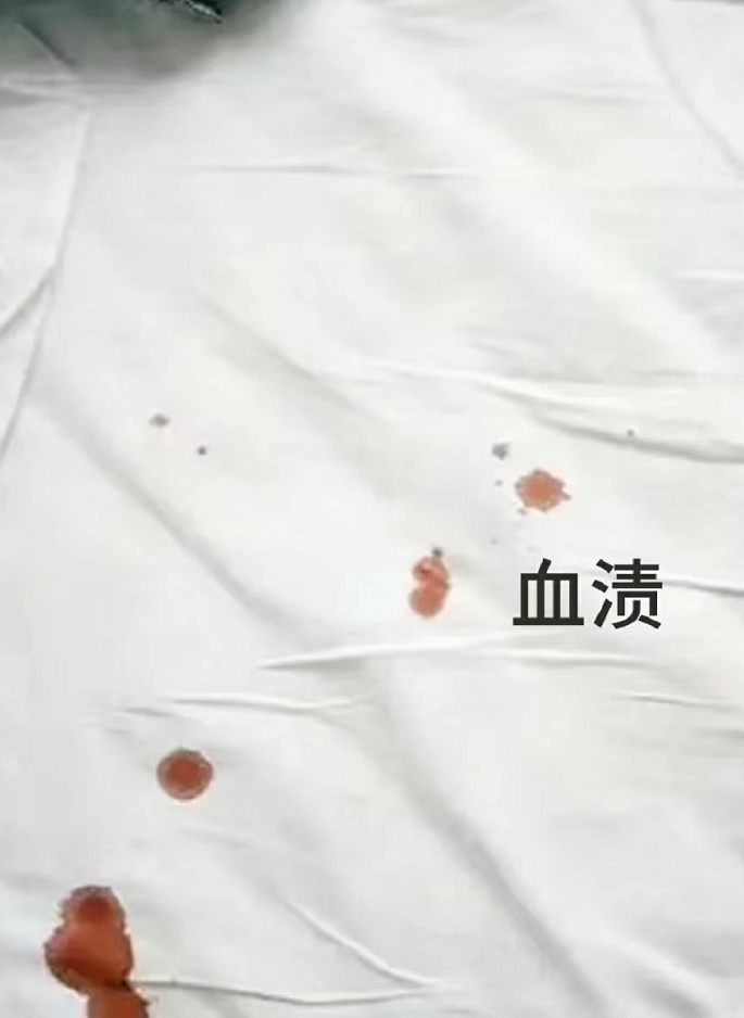 还在为衣服污渍烦恼吗？教你一招轻松搞定