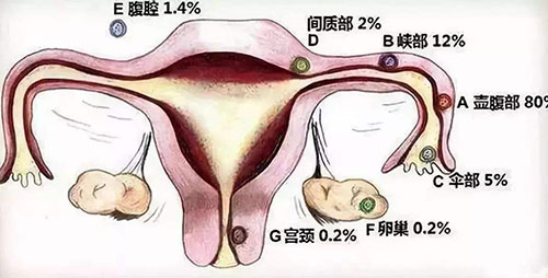 怀孕初期出血是怎么回事 孕早期出血的原因