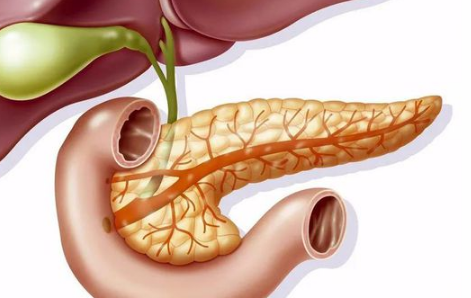 诊断胰腺炎但一直不疼严重吗3