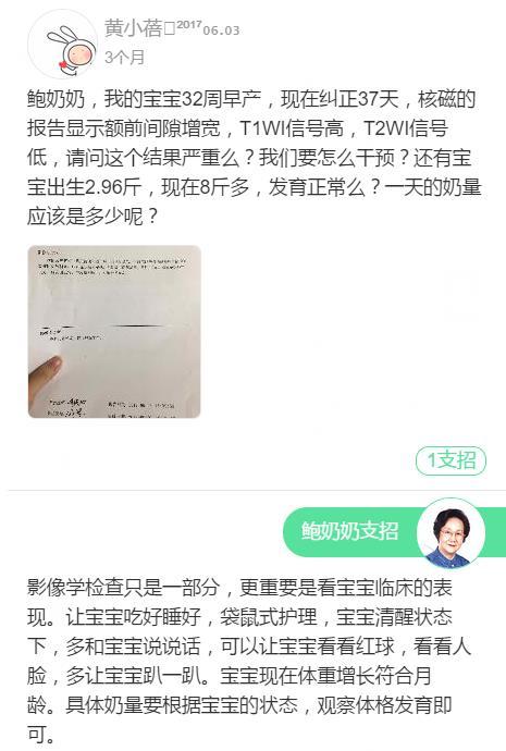 小孩刚学说话为什么只会说叠字（说叠字会让宝宝语言发展滞后）