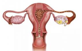 切除子宫对身体的伤害有哪些，什么病需要切除子宫